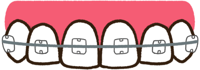 クリアブラケット